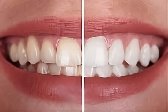 tratamientos estetica