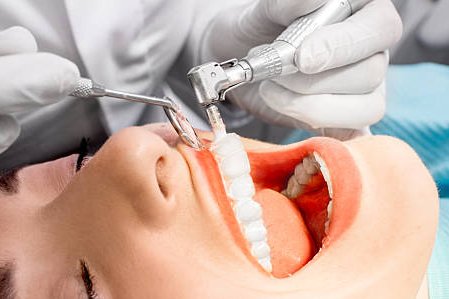 tratamientos limpiezas-dentales